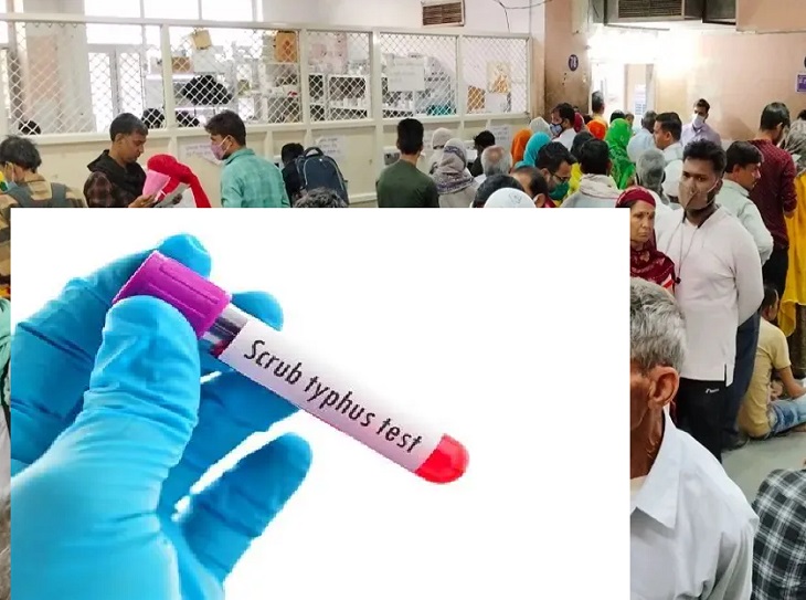 स्क्रब टाइफस से युवक की मौत, स्वास्थ्य विभाग अलर्ट